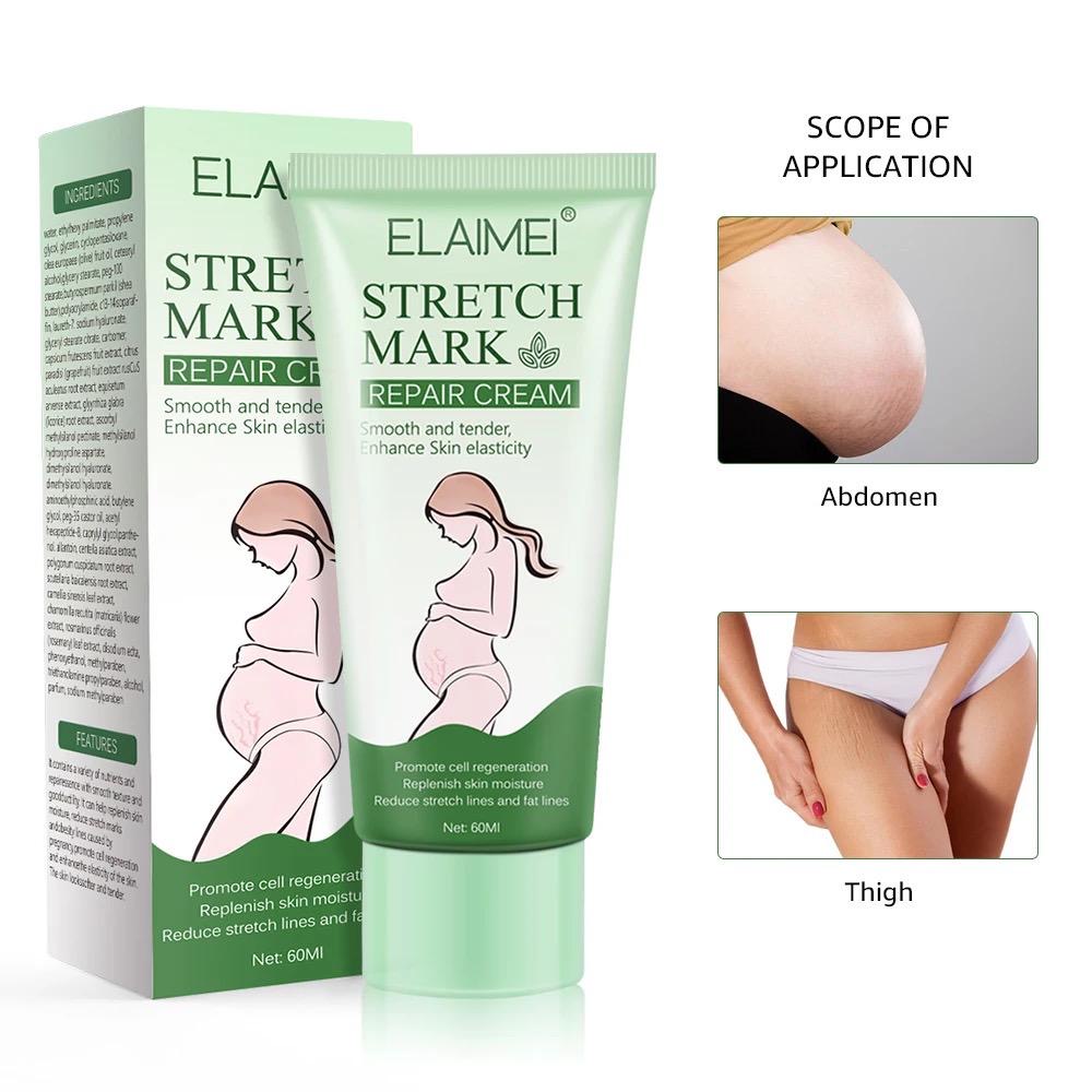 Stretch mark cream. Repair cream