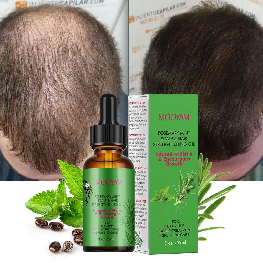 Hair growth oil